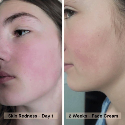 Hydration Recovery Face Cream